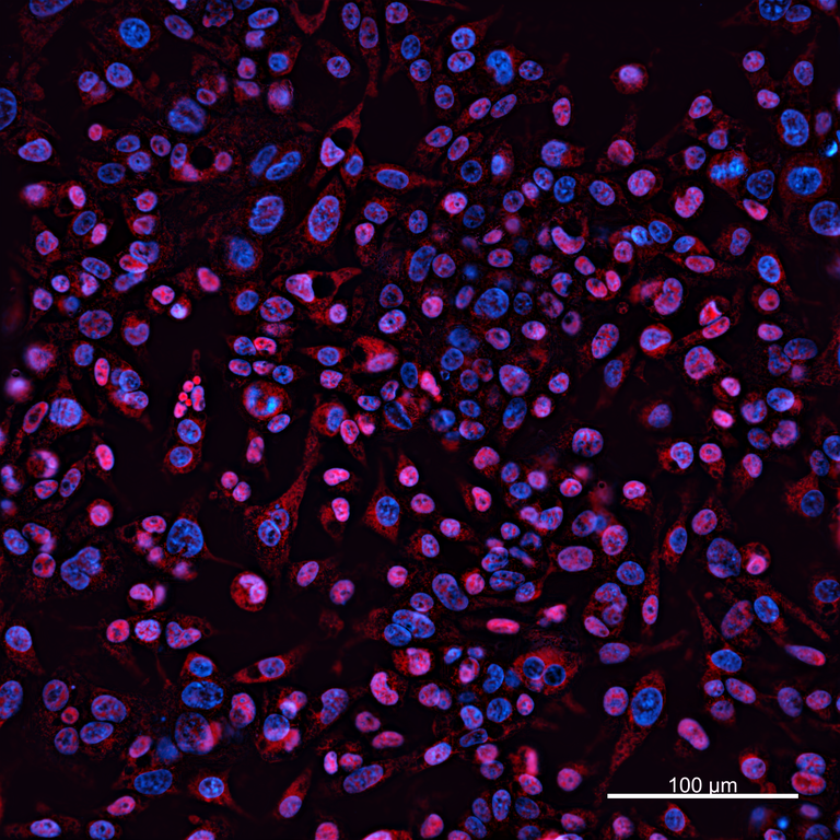 Ankyron IBP3_HUMAN Clone BC40429