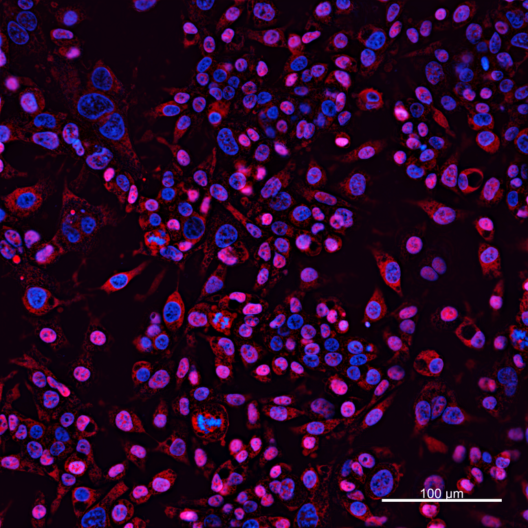 Ankyron IBP4_HUMAN Clone CB30624