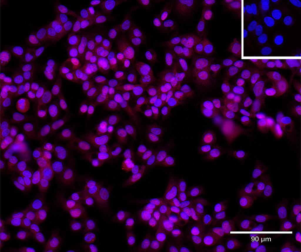 Ankyron IBP6_HUMAN Clone BG40392