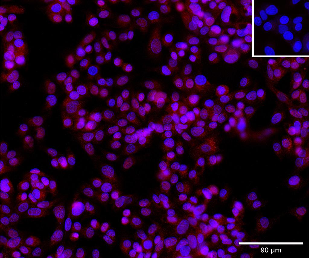 Ankyron IBP6_HUMAN Clone BG40395