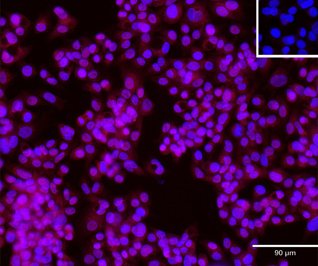 Ankyron IBP6_HUMAN Clone BG40394