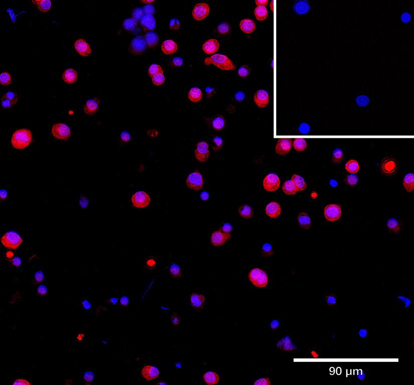 Ankyron IDS_HUMAN Clone CU30389