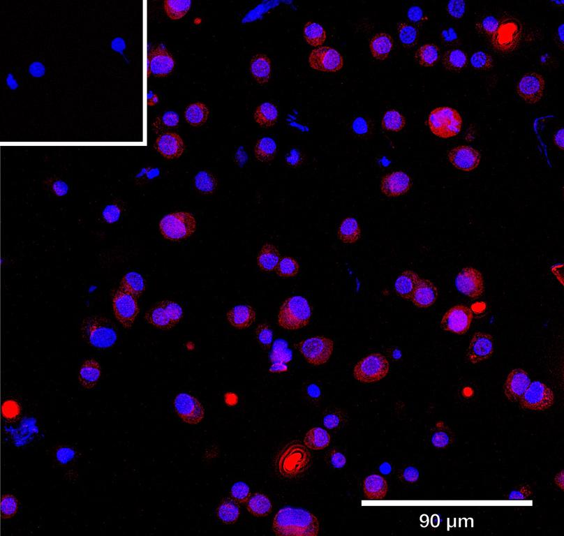 Ankyron IDS_HUMAN Clone CU30384