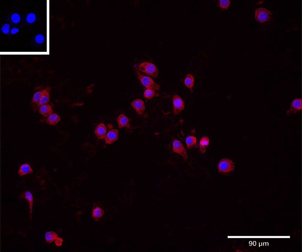 Ankyron IFNA1_MOUSE Clone CY40633