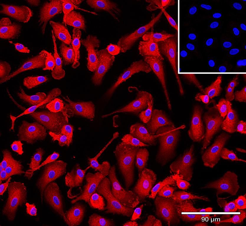 Ankyron IFNA2_HUMAN Clone AB40280