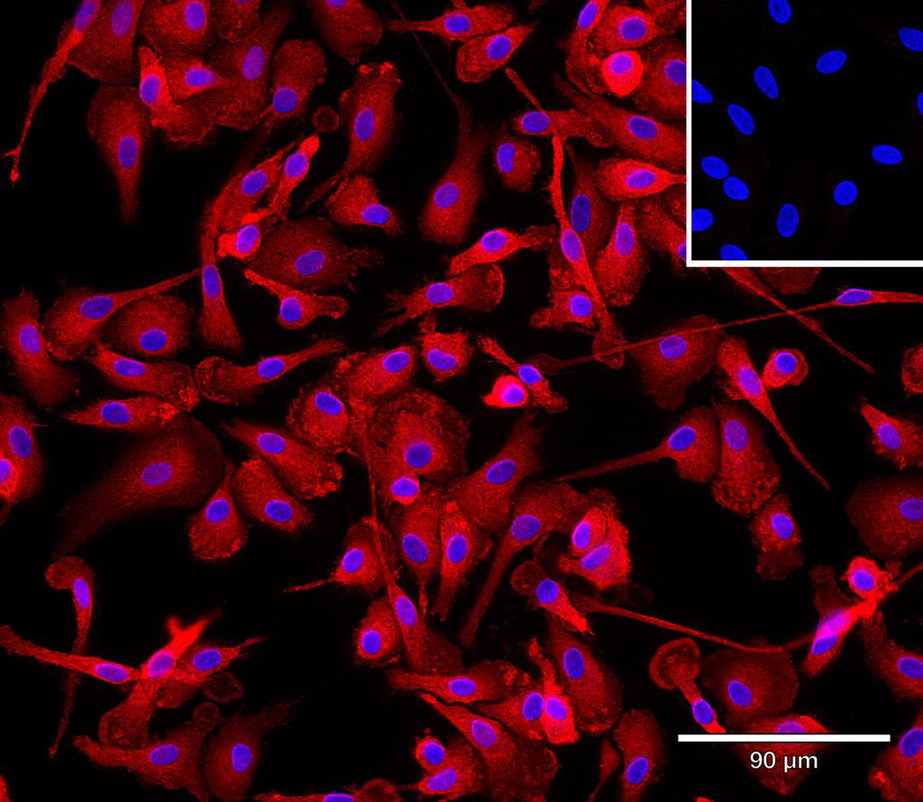 Ankyron IFNA2_HUMAN Clone AB40284