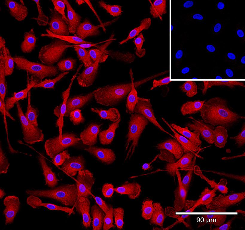 Ankyron IFNA2_HUMAN Clone AB40289