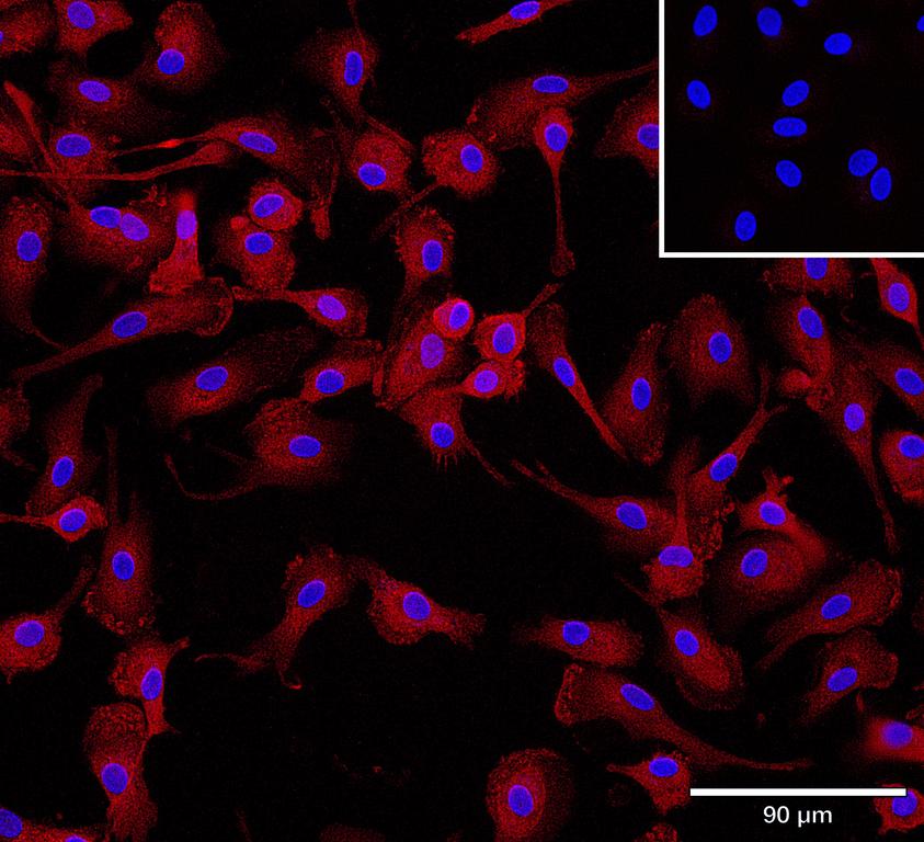 Ankyron IFNA2_HUMAN Clone AB40276