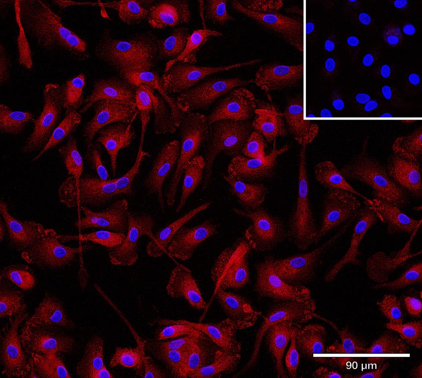 Ankyron IFNA2_HUMAN Clone AB40286