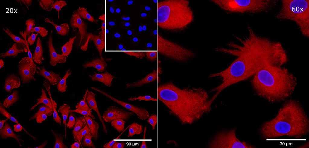 Ankyron IFNA2_HUMAN Clone AB40278