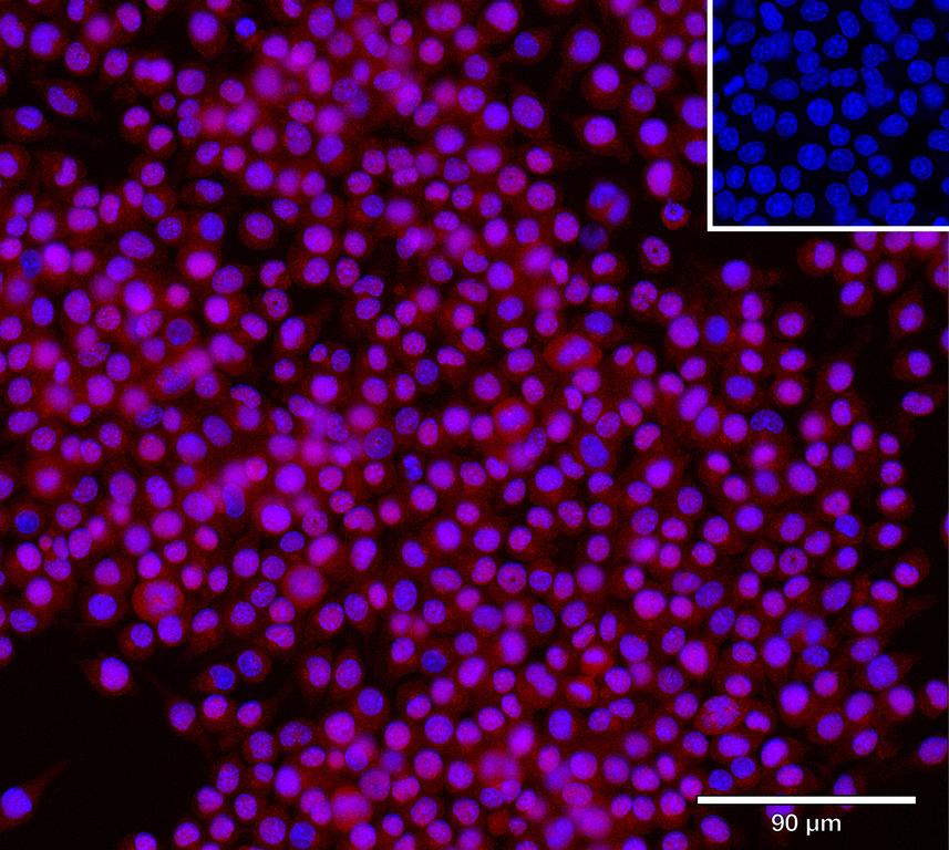 Ankyron IFNA2_MOUSE Clone CY40165