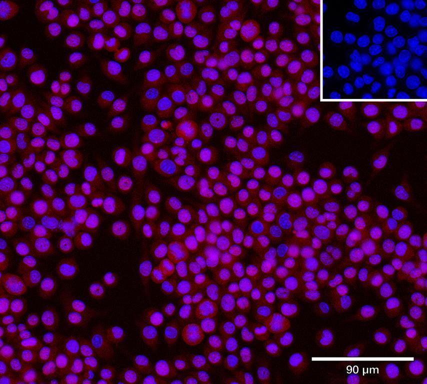 Ankyron IFNA2_MOUSE Clone CY40181