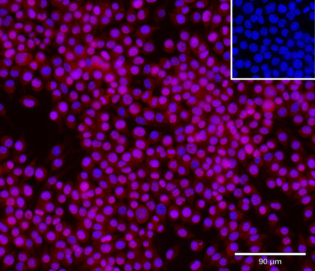 Ankyron IFNA2_MOUSE Clone CY40174