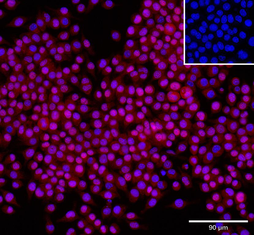 Ankyron IFNA2_MOUSE Clone CY40178