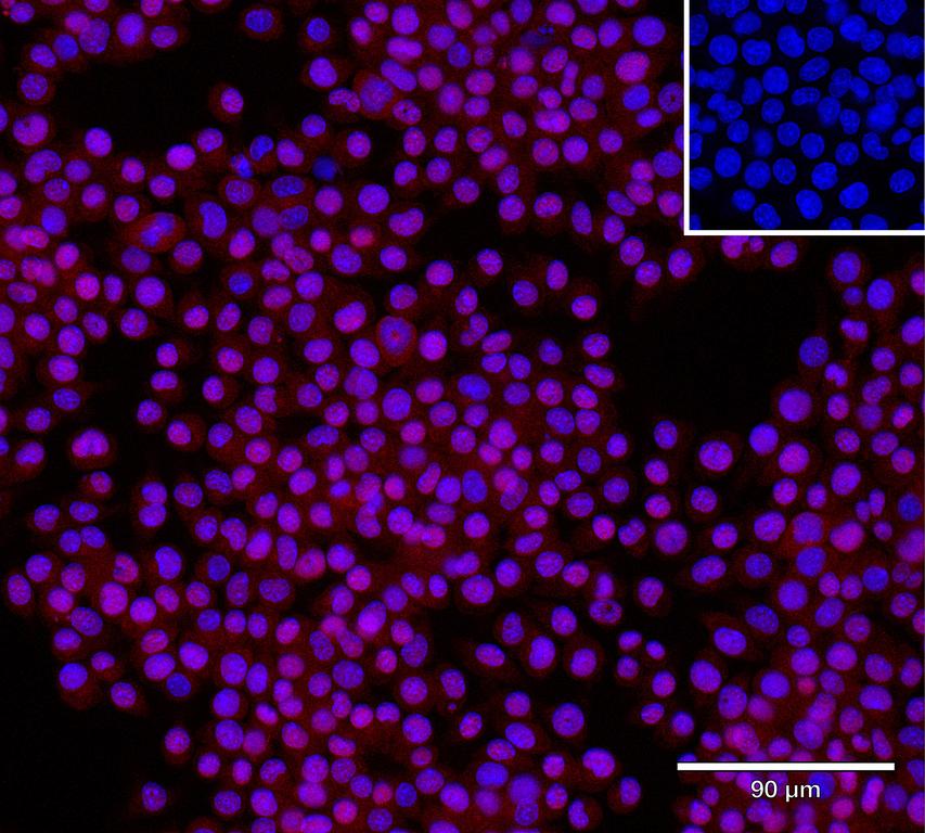 Ankyron IFNA2_MOUSE Clone CY40171