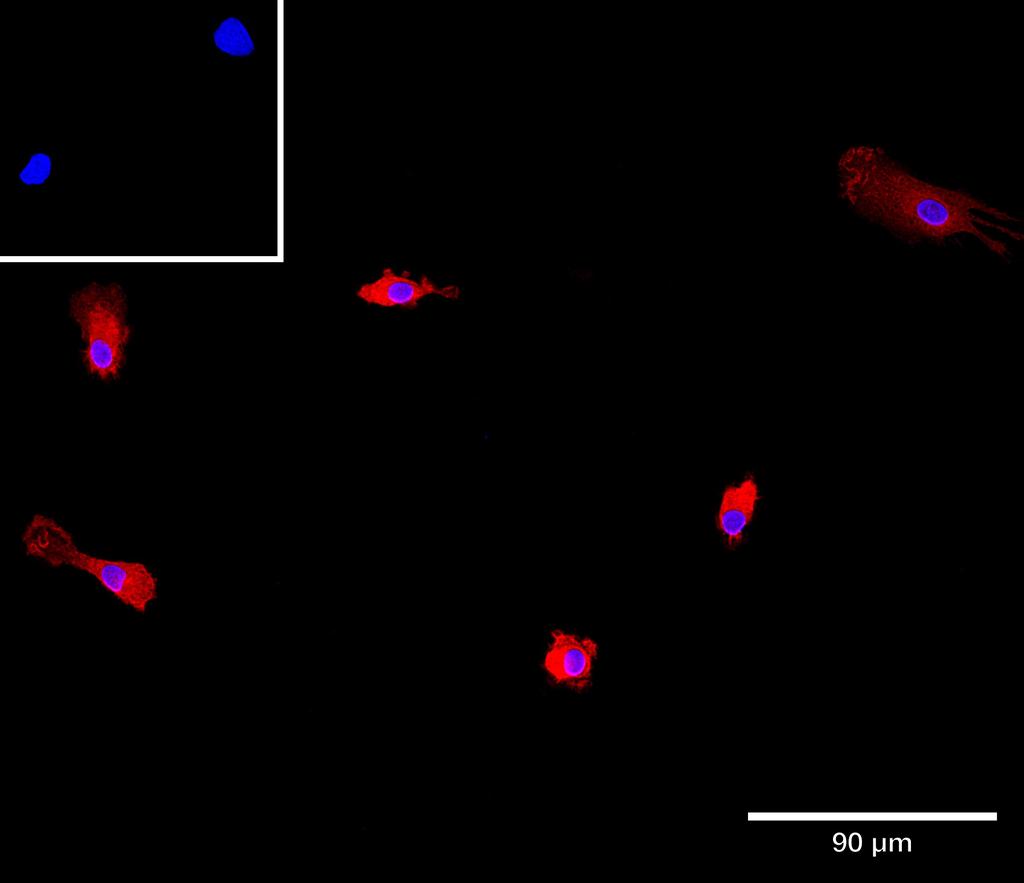 Ankyron IFNA4_HUMAN Clone AG50138