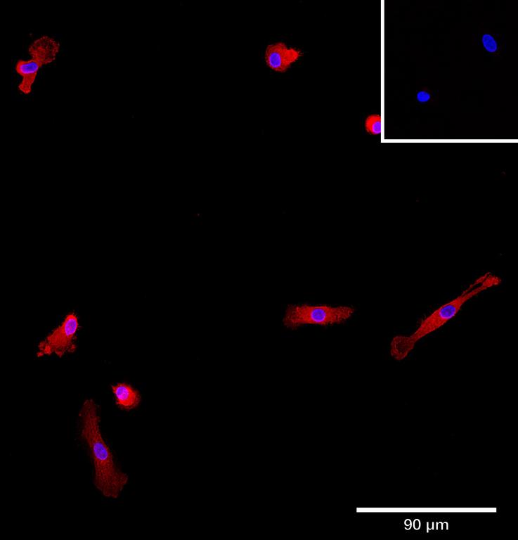 Ankyron IFNA4_HUMAN Clone AG50139