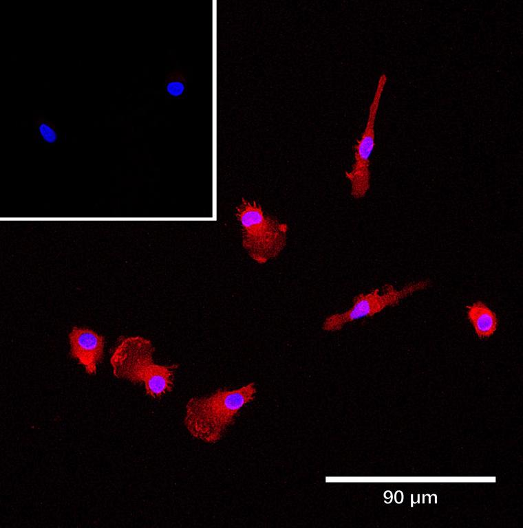 Ankyron IFNA4_HUMAN Clone BA41217
