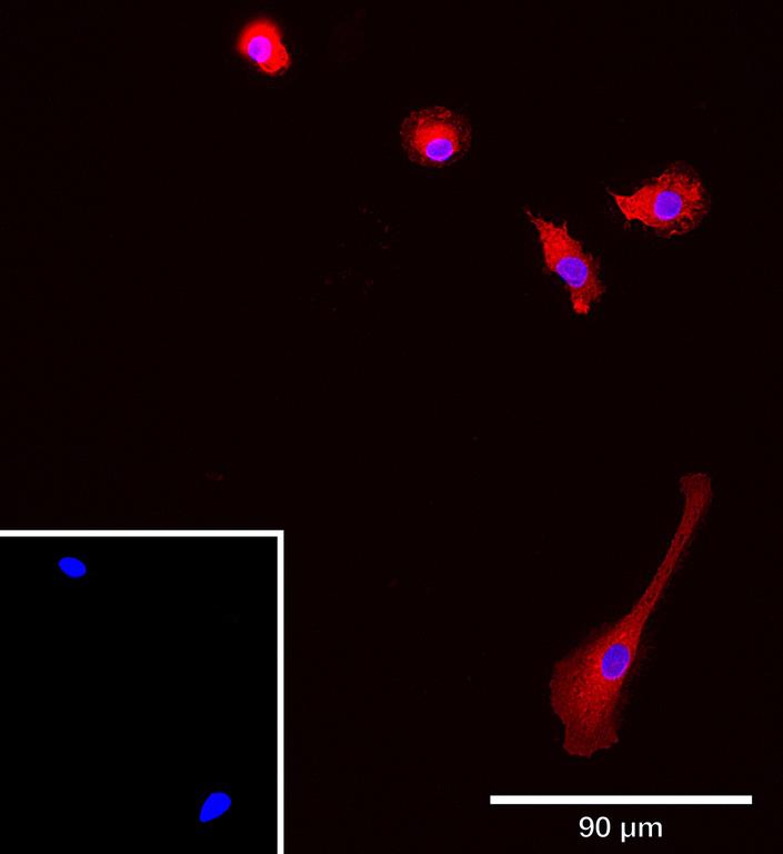 Ankyron IFNA4_HUMAN Clone BA41223