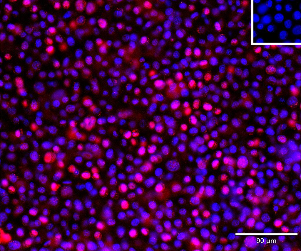 Ankyron IFNA5_HUMAN Clone CC30482