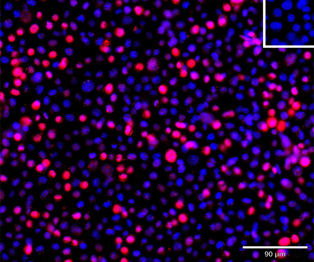 Ankyron IFNA5_HUMAN Clone CC30487