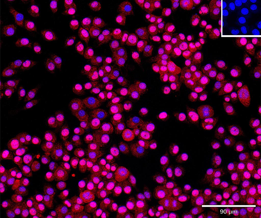 Ankyron IFNA5_MOUSE Clone CN40183