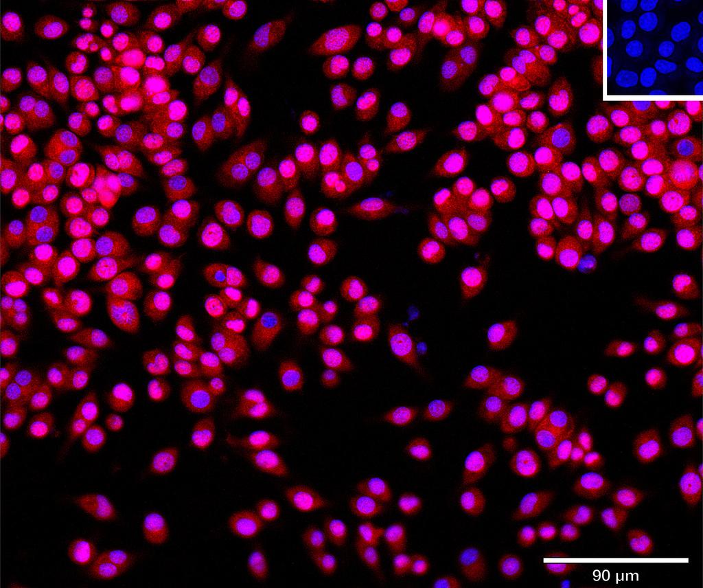 Ankyron IFNA5_MOUSE Clone CN40184