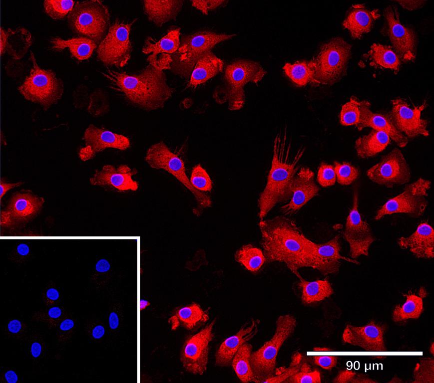 Ankyron IFNA8_HUMAN Clone AW40545