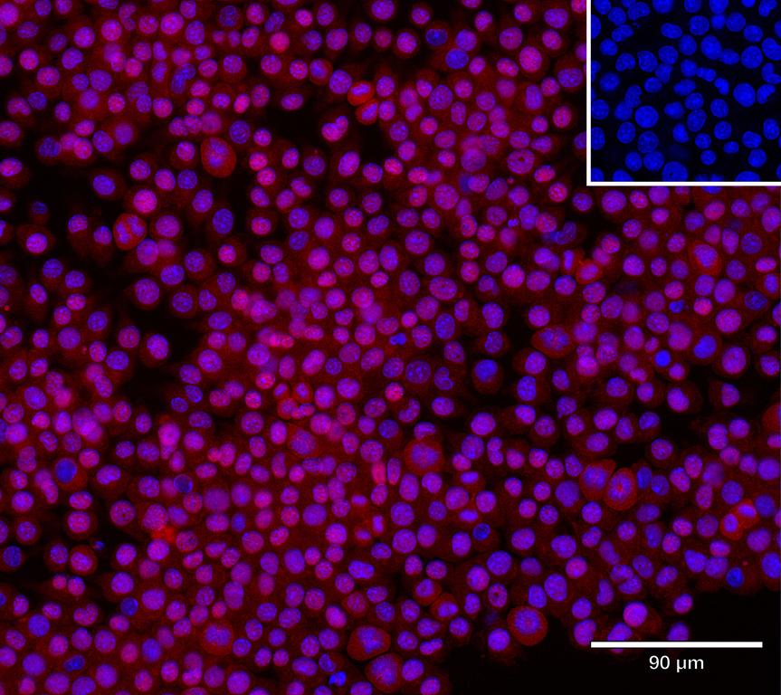 Ankyron IFNB_MOUSE Clone CY40224