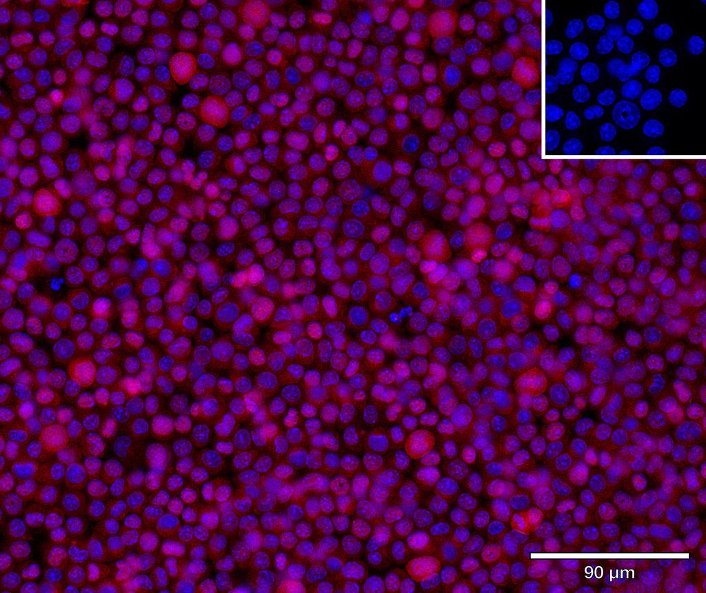 Ankyron IFNB_MOUSE Clone CY40221