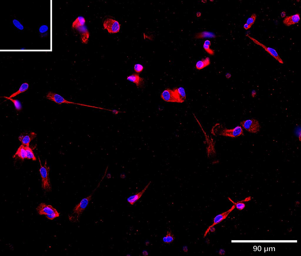 Ankyron IFNG_HUMAN Clone AR40194