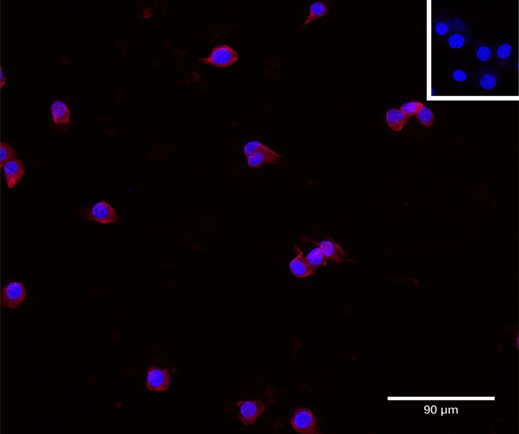 Ankyron IFNG_MOUSE Clone DV40670