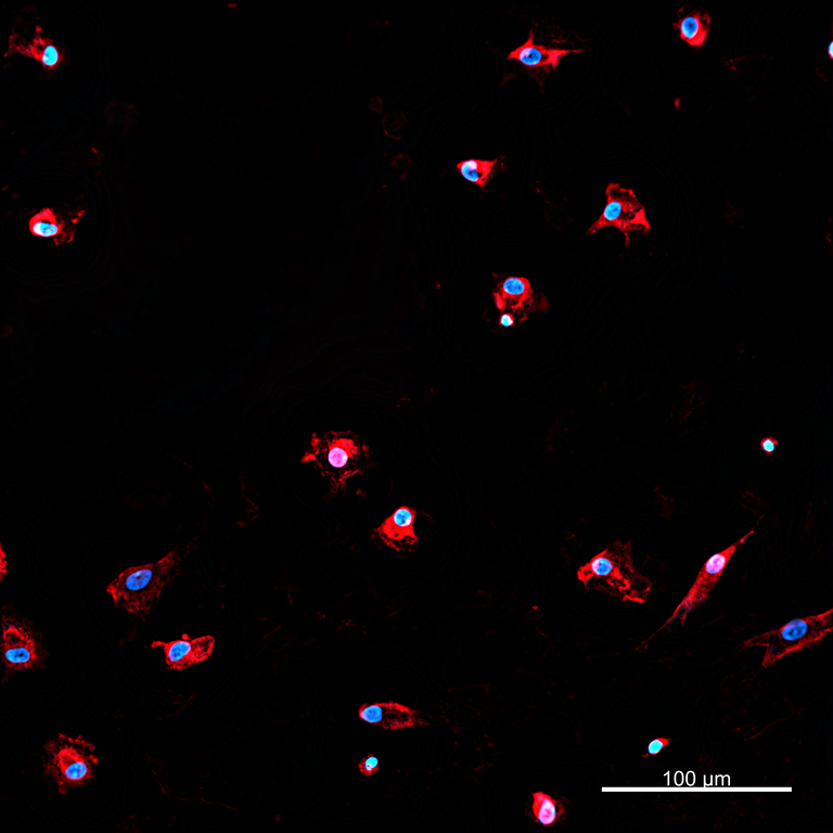 Ankyron IFNL1_HUMAN Clone BA40903