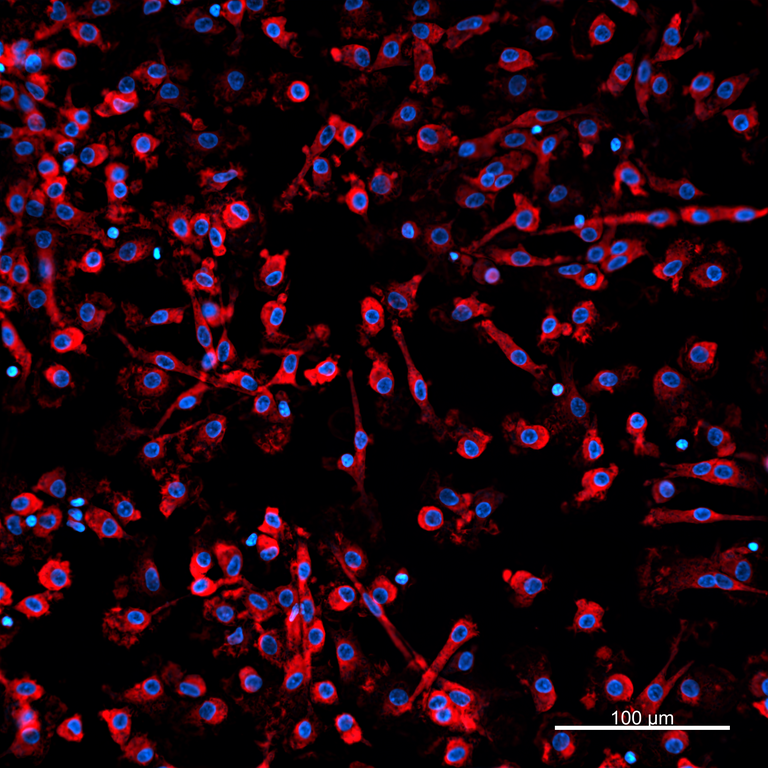 Ankyron IFNL1_HUMAN Clone BA40894