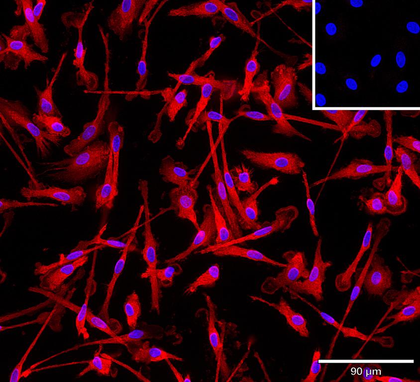 Ankyron IFNL1_HUMAN Clone BA40892