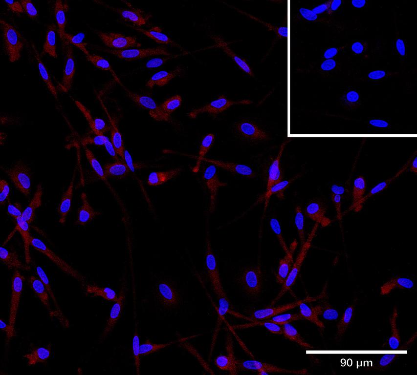 Ankyron IFNL1_HUMAN Clone BA40893