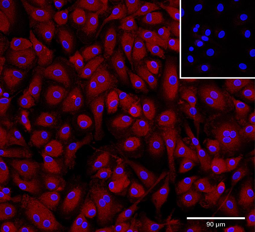 Ankyron IFNL1_HUMAN Clone BA40904