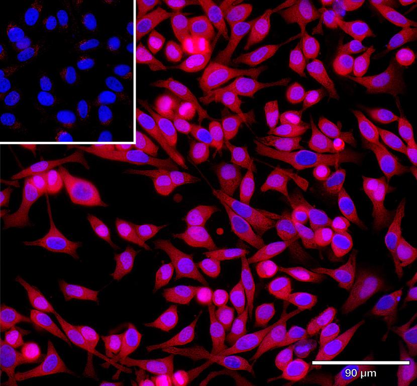 Ankyron IFNL2_HUMAN Clone CT30870
