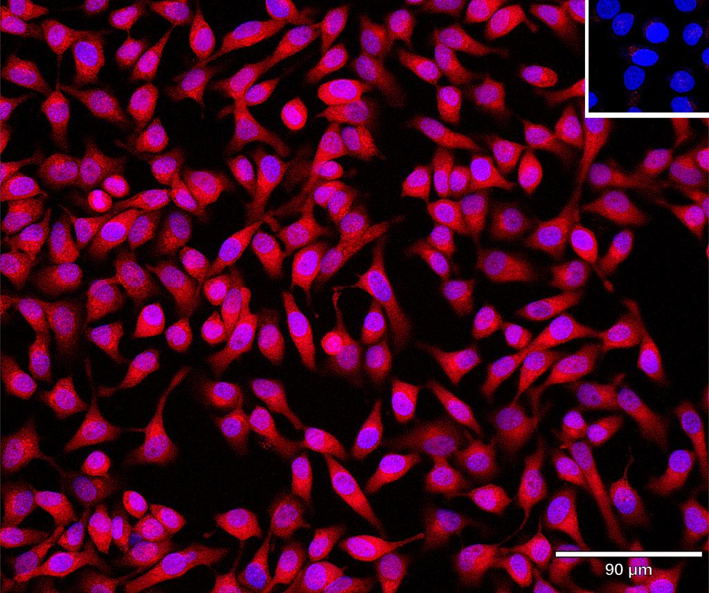 Ankyron IFNL3_HUMAN Clone BS40625