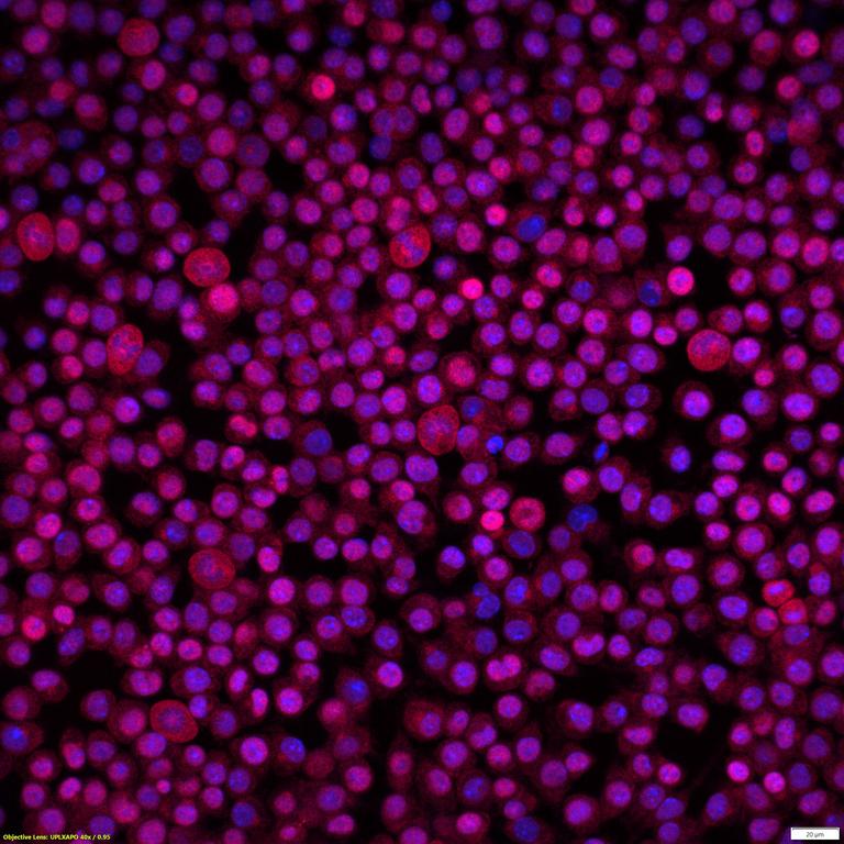 Ankyron IFNL3_MOUSE Clone CX40608