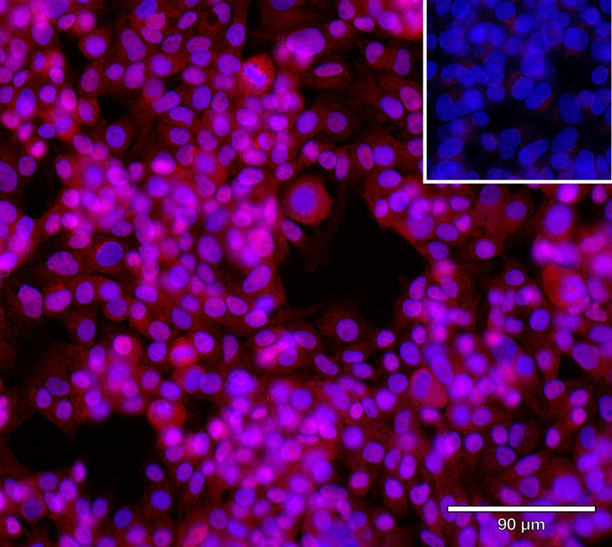 Ankyron IFNW1_HUMAN Clone AG50177