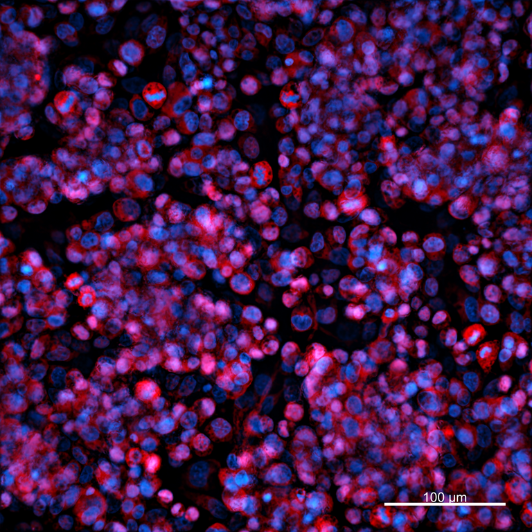 Ankyron IGF1_HUMAN Clone AG40285