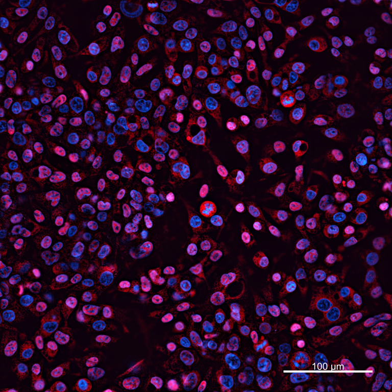 Ankyron IGF1_HUMAN Clone AG40278