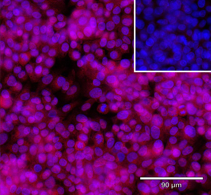 Ankyron IGF1_HUMAN Clone AG40284