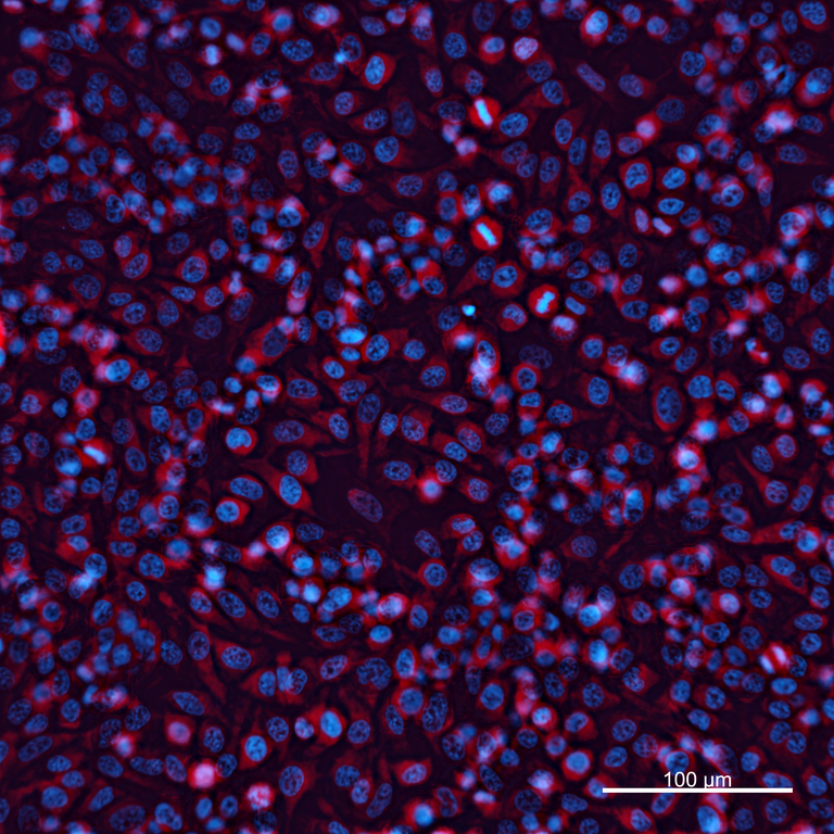 Ankyron IGF2_HUMAN Clone BC40375