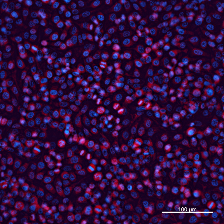 Ankyron IGF2_HUMAN Clone BC40378