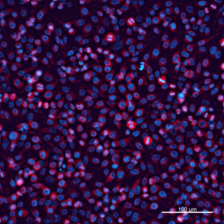 Ankyron IGF2_HUMAN Clone BC40372