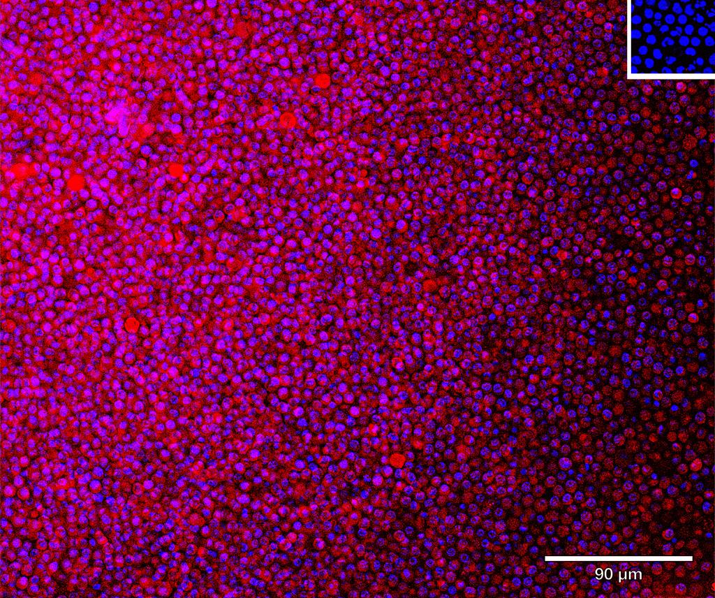 Ankyron IGLC6_HUMAN Clone CJ30174