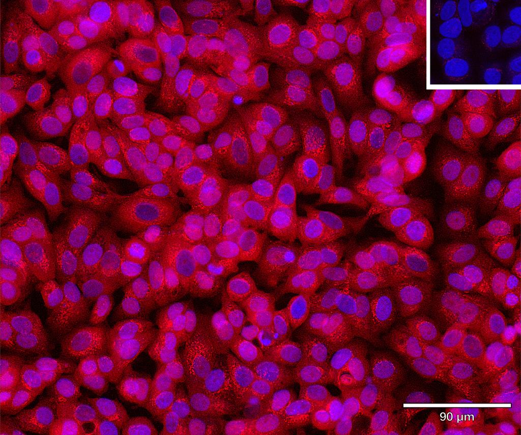 Ankyron IGSF3_HUMAN Clone AU40944