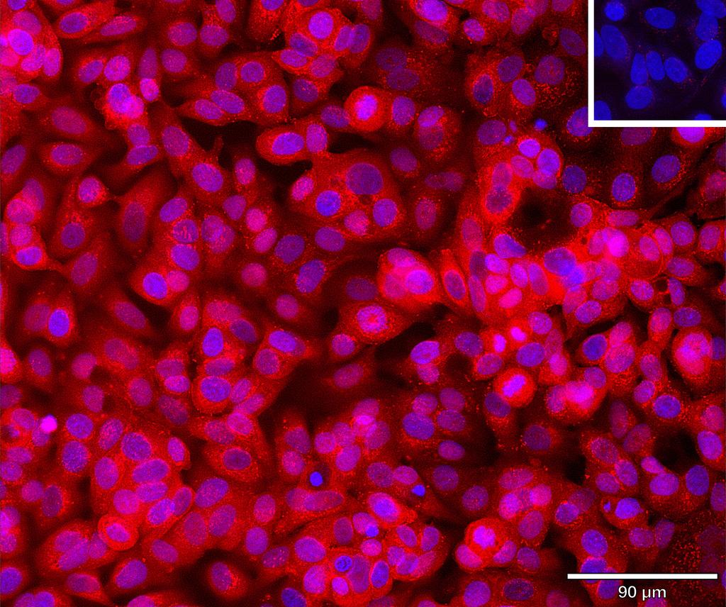 Ankyron IGSF3_HUMAN Clone AU40945